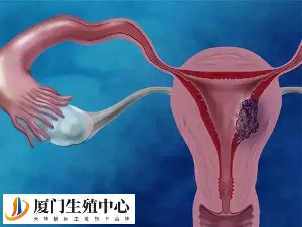 导致宫寒的原因有哪些