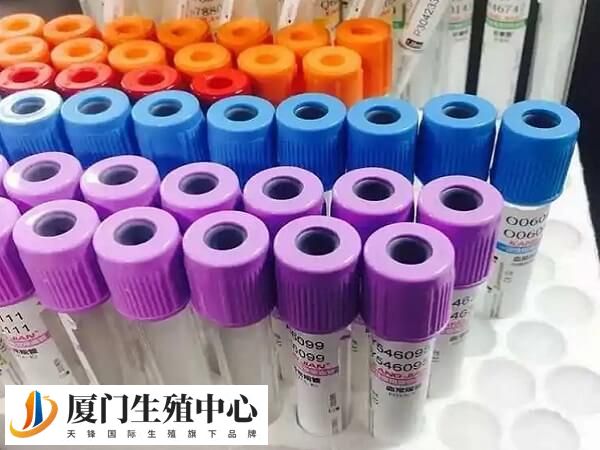 试管移植前要检查孕酮水平