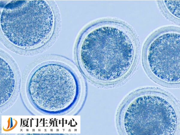 黄体期促排方案适合哪些人群