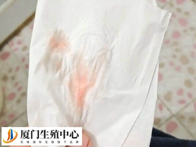 试管移植后有血丝是着床了