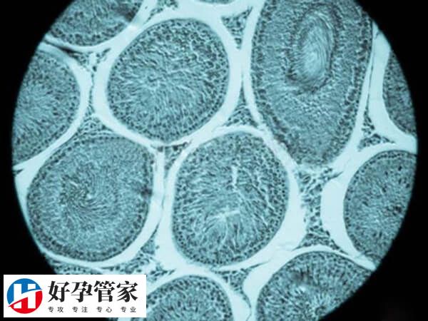 监测窦卵泡的最佳时间是多久
