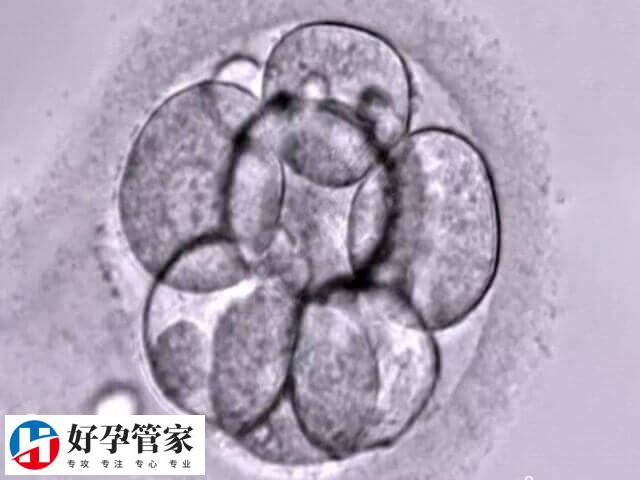 卵泡质量是决定受精成败的关键因素